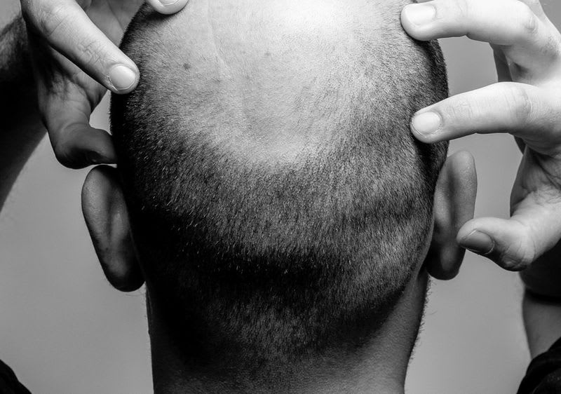 Haare haarausfall kurze männer Männer Kurzhaarfrisuren