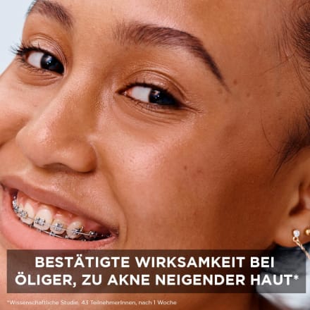 kaufen online Garnier Hautklar 150 3in1 Reinigungsgel Anti-Mitesser, Active Skin ml günstig dauerhaft