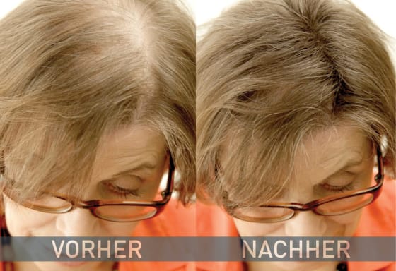 Streuhaar Haarverdichter 14 g Mittelbraun,